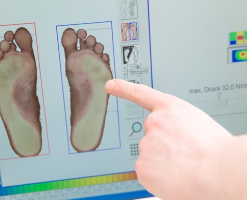 Umfassende Analysetechniken von Carepoint