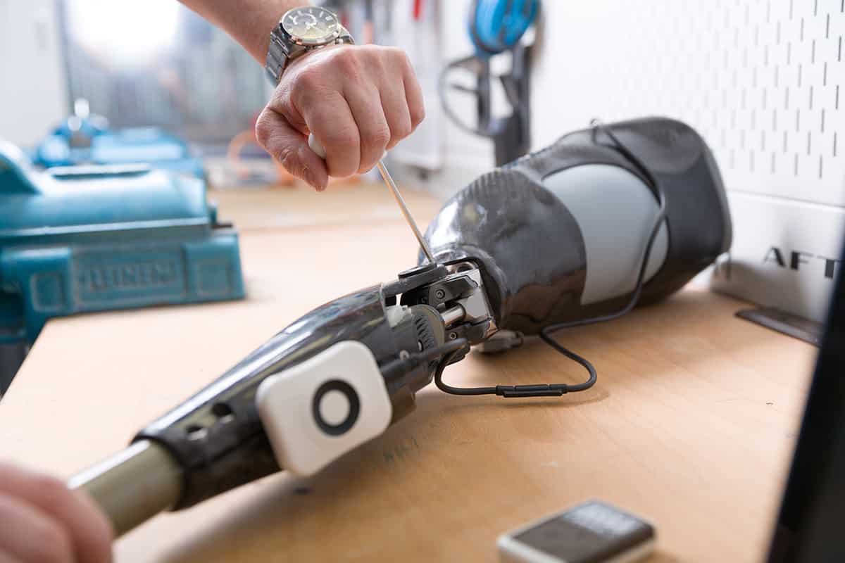 Technologisch auf dem aktuellsten Stand mit der Prothesenversorgung von Carepoint