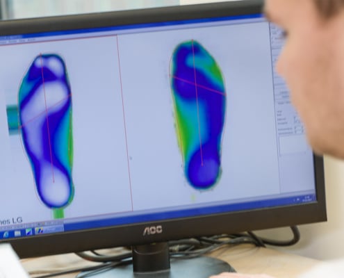 Moderne Analyse und Passende Hilfsmittel zur Diabetes Fußversorgung