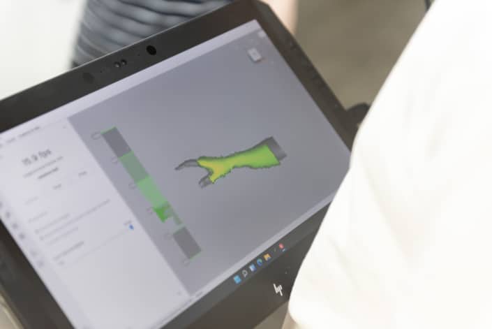 Analyse des Handgelenks im Vorfeld einer orthopädischen Versorung