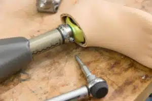 spezialversorgung im sanitätshaus