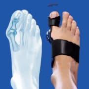 hallux valgus endlich schmerzfrei